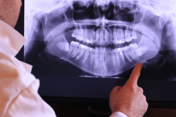 Best Emergency Tooth Extraction in Brownsville, PA